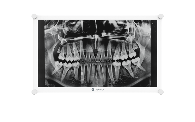 Dental monitor_DICOM