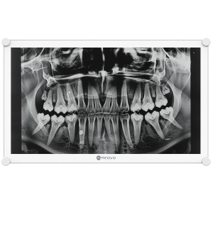 Dental monitor_DICOM_S