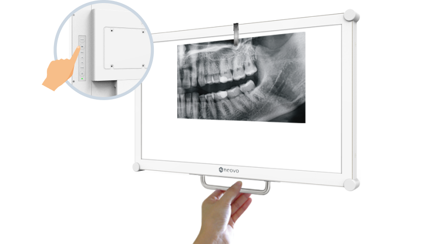 DR2202_Accessible X-Ray Film Viewing with Customisable Accessories